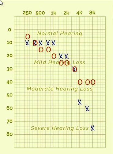 Hearing%20without%20aids