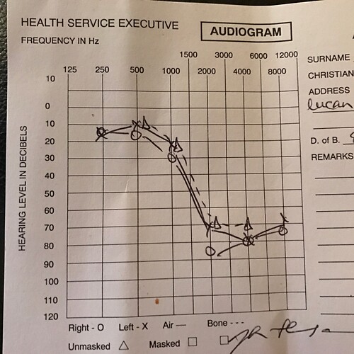 audiogram