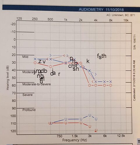 JackAudiogram2018