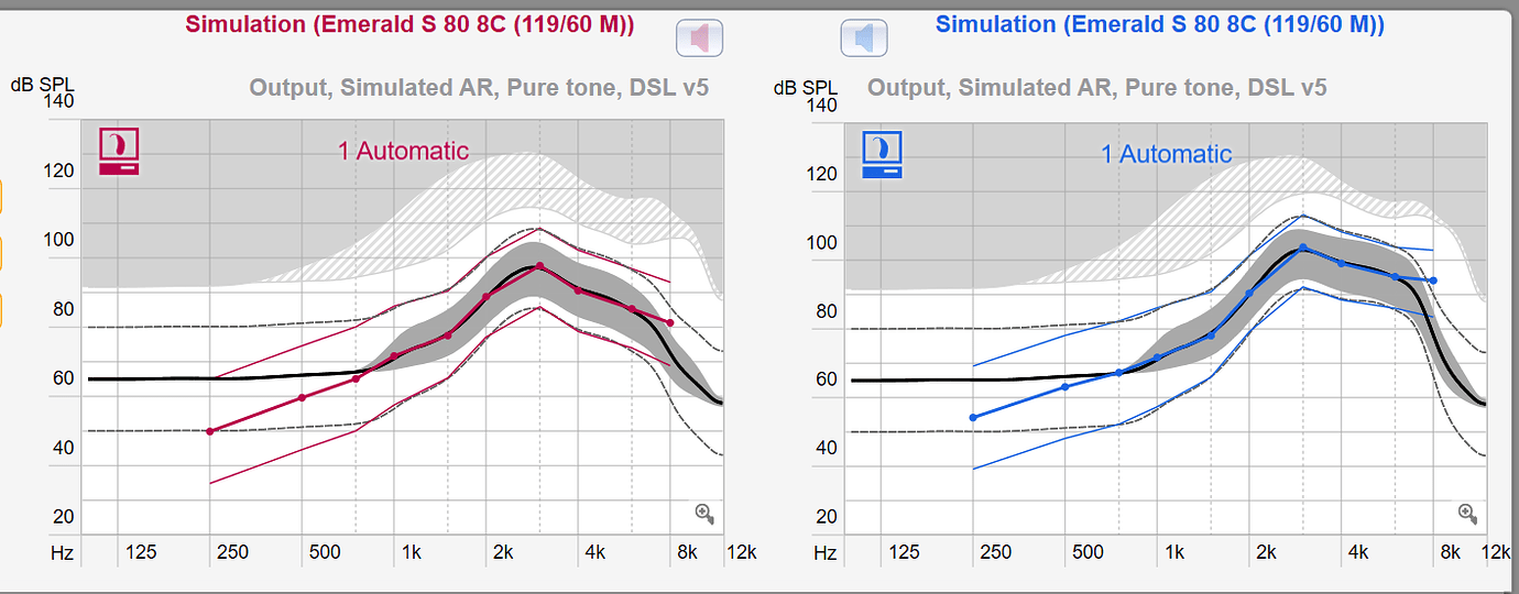 Anyone buy HA's through Kaiser Permanente? Hearing Aids Hearing Aid