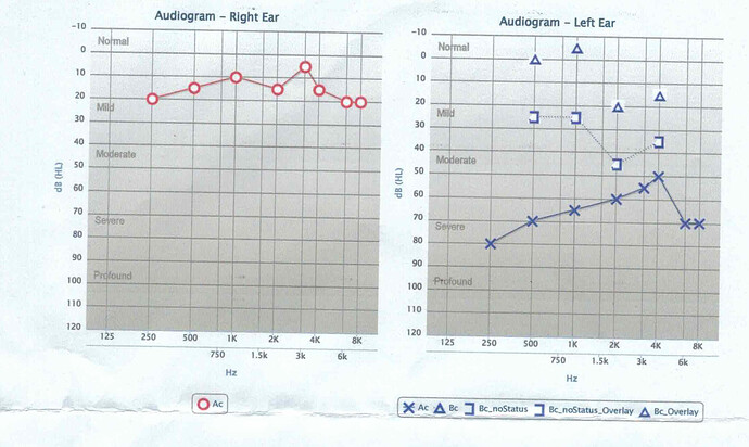 hearing-audiogram-cropped