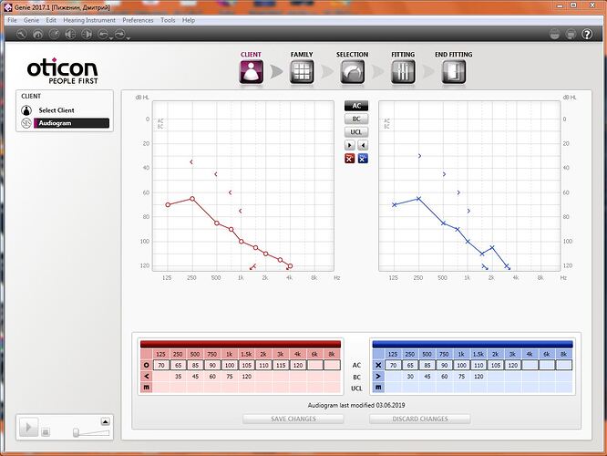 audiogram