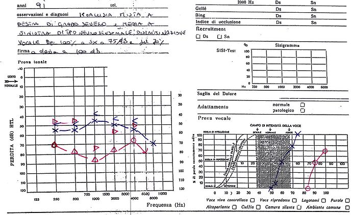 otorino audiogramma tonale vocale