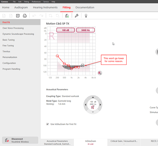 audiogram setting