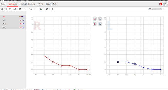 Final audiogram with clear performance