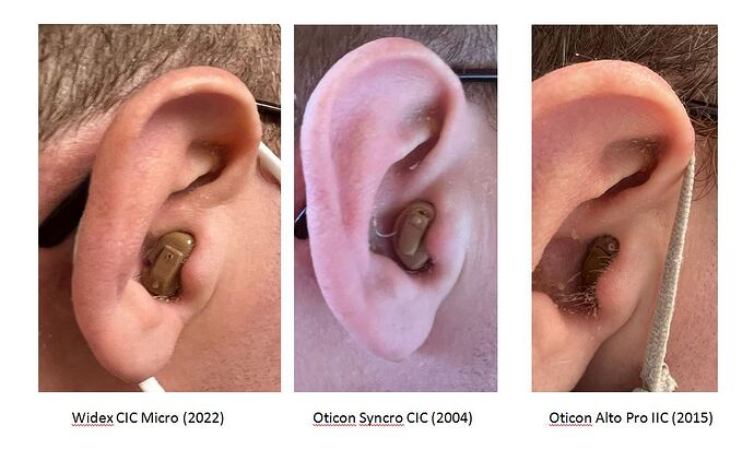 Hearing Aids