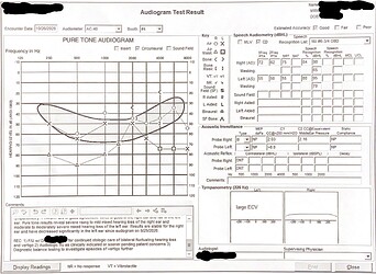 Hearing Exam 2020-10-26