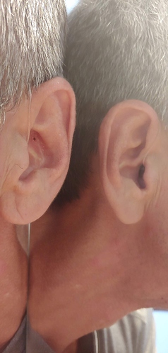 ear2