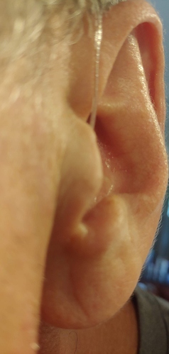ear%201