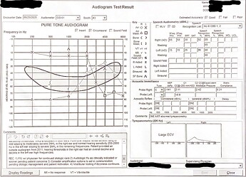 Hearing Exam 2020-08-25