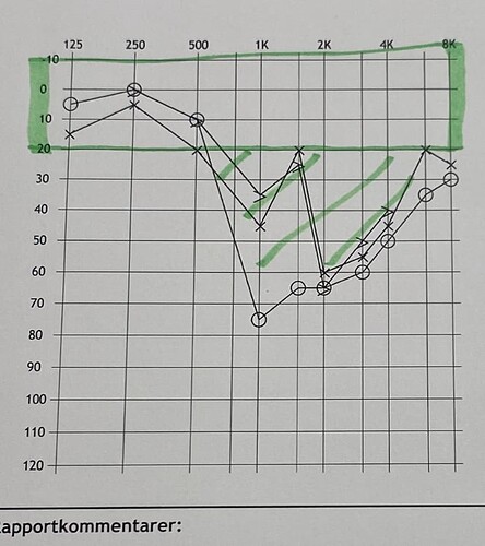 Audiogram