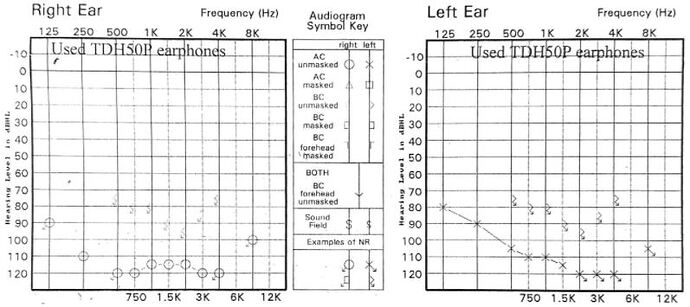 hearing