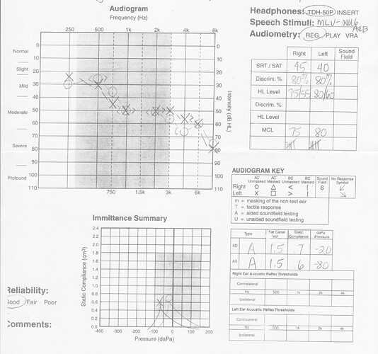 Audiogram