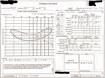 Hearing Exam 2021-01-04