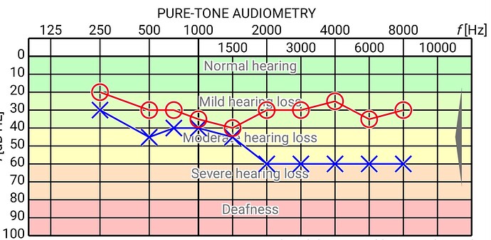 Screenshot_20230328_063837_Hearing Test