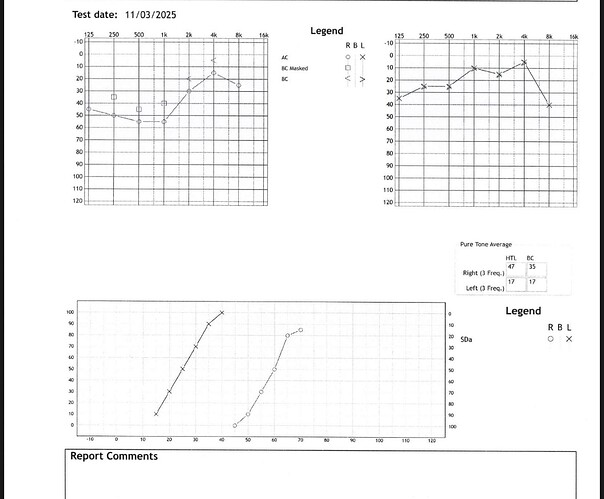 audiogram