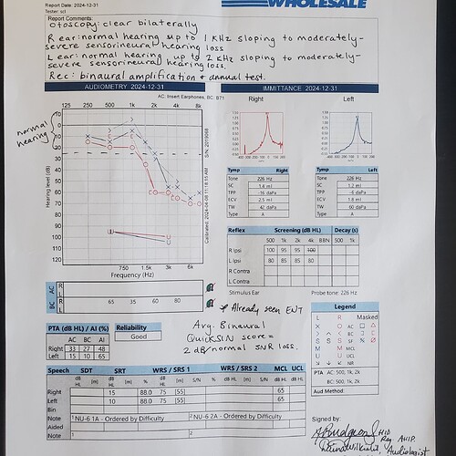 Audiogram - Costco Dec 2024