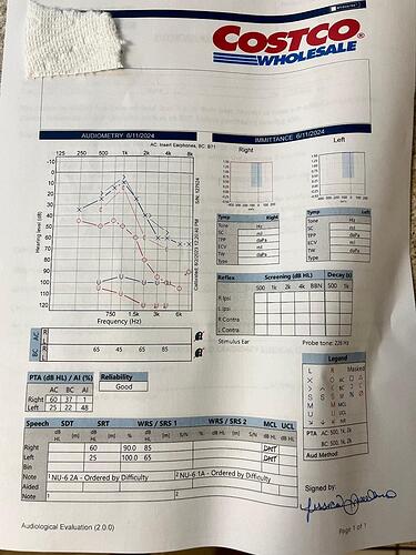 audiogram