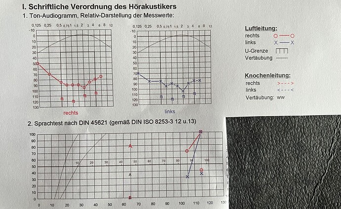 Hördiagramm