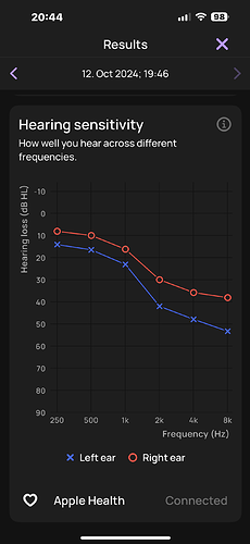 My Audiogram