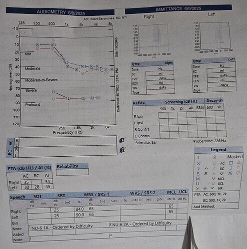 Audiogram