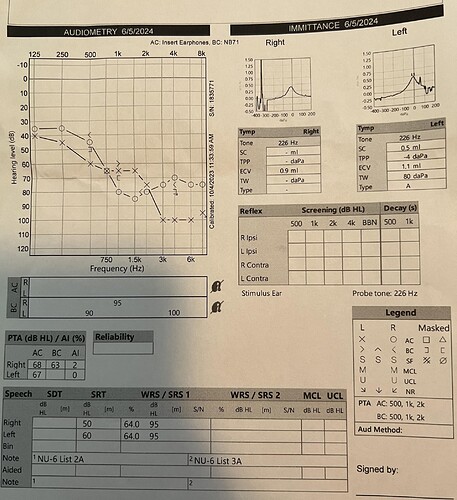 audiogram