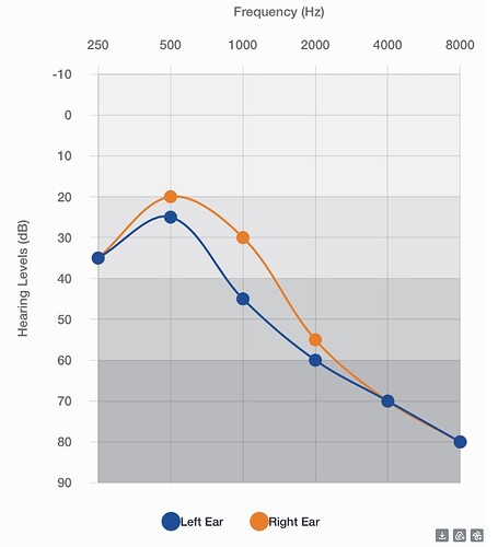 Audiogram 8.2025