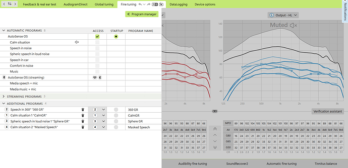 Fine tuning No Say AutoSense 1