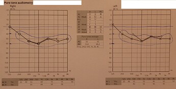 Audiogram