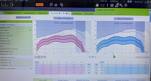 PHONAK TARGET ADJUST 1 MAY