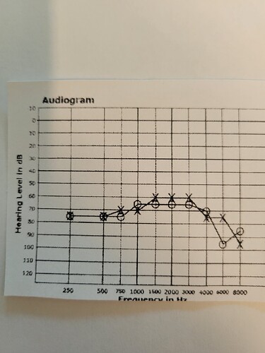 !audiogram only 9-16-2024