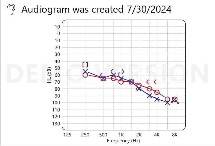 Audiogram