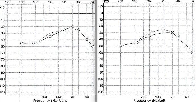2022 Audiogram RT:LFT