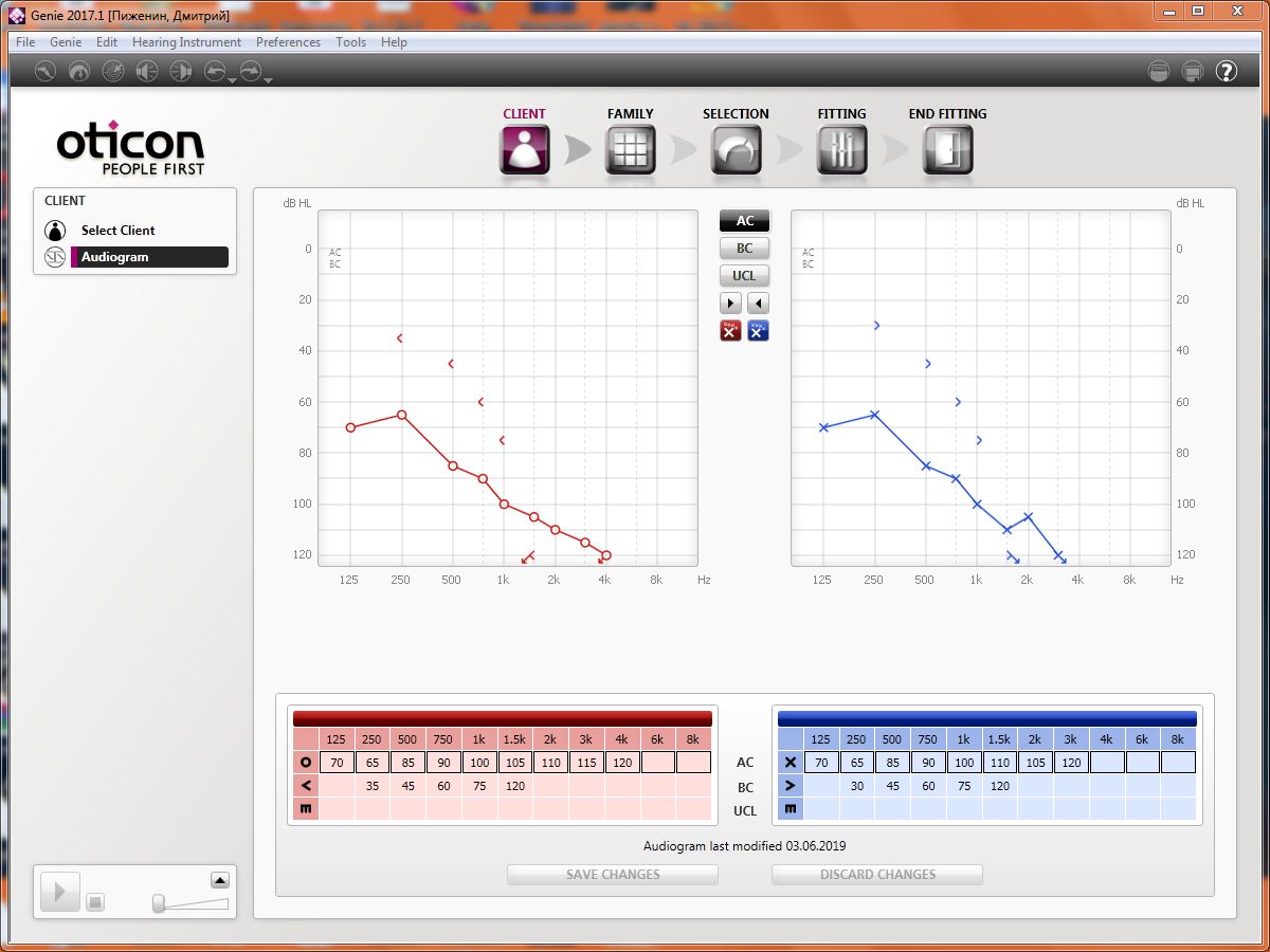 audiogram