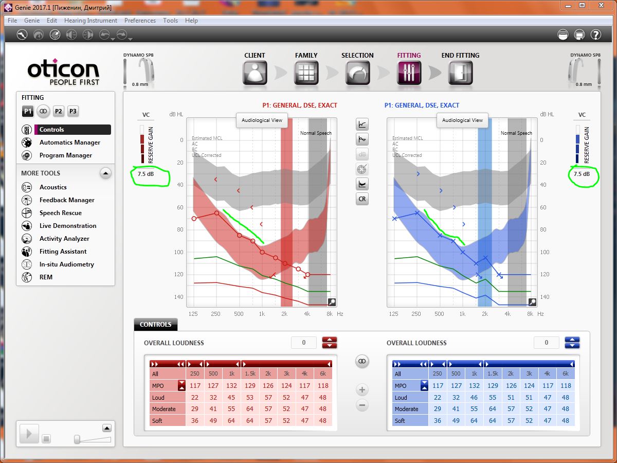 dynamo%20Audiological%20view