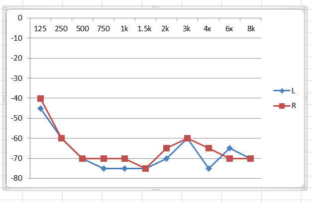 Audiogram