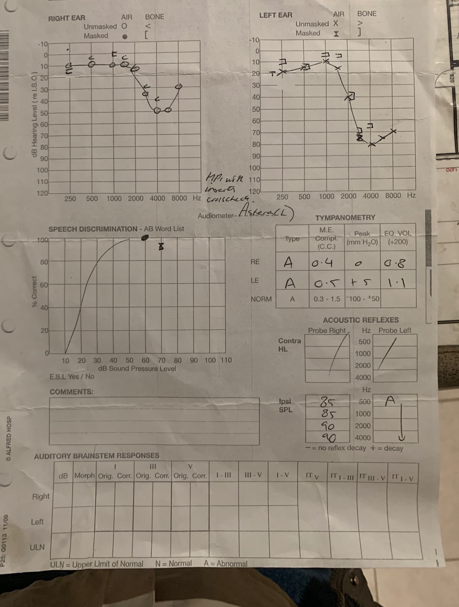 Unbelievable! Brian Regan'S Hearing Test Results Will Shock You - mwbw3h5