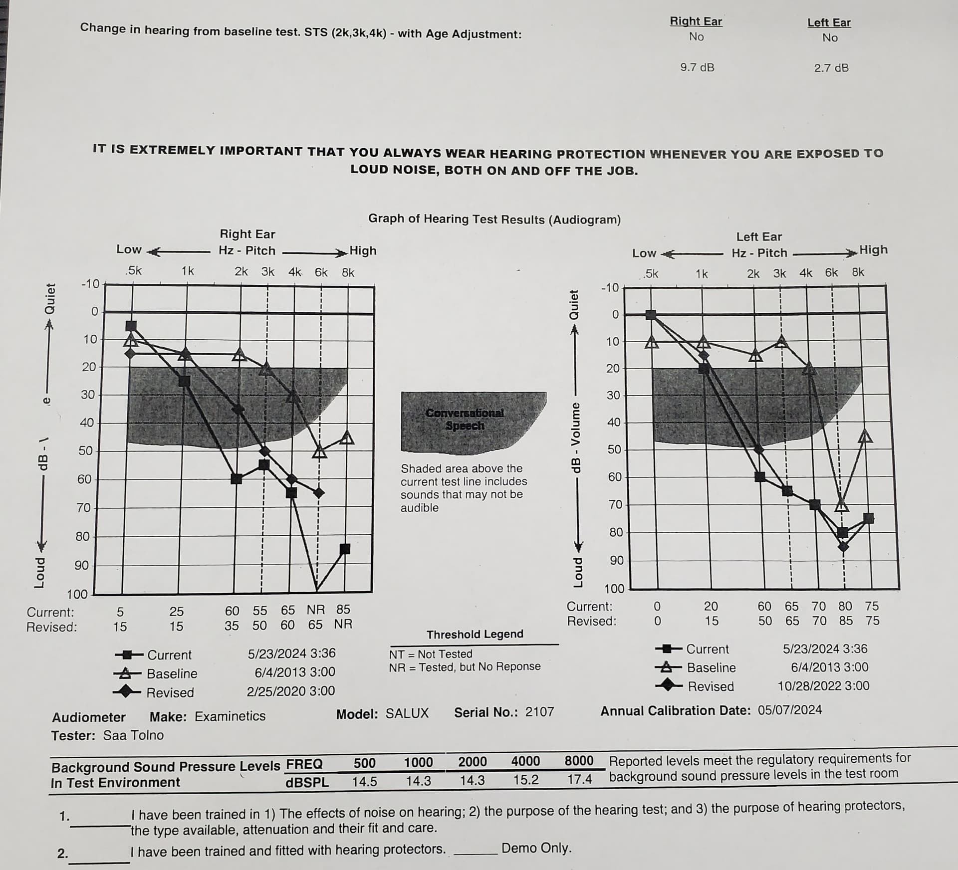 First Time User Help With Selecting Hearing Aids Hearing Aids